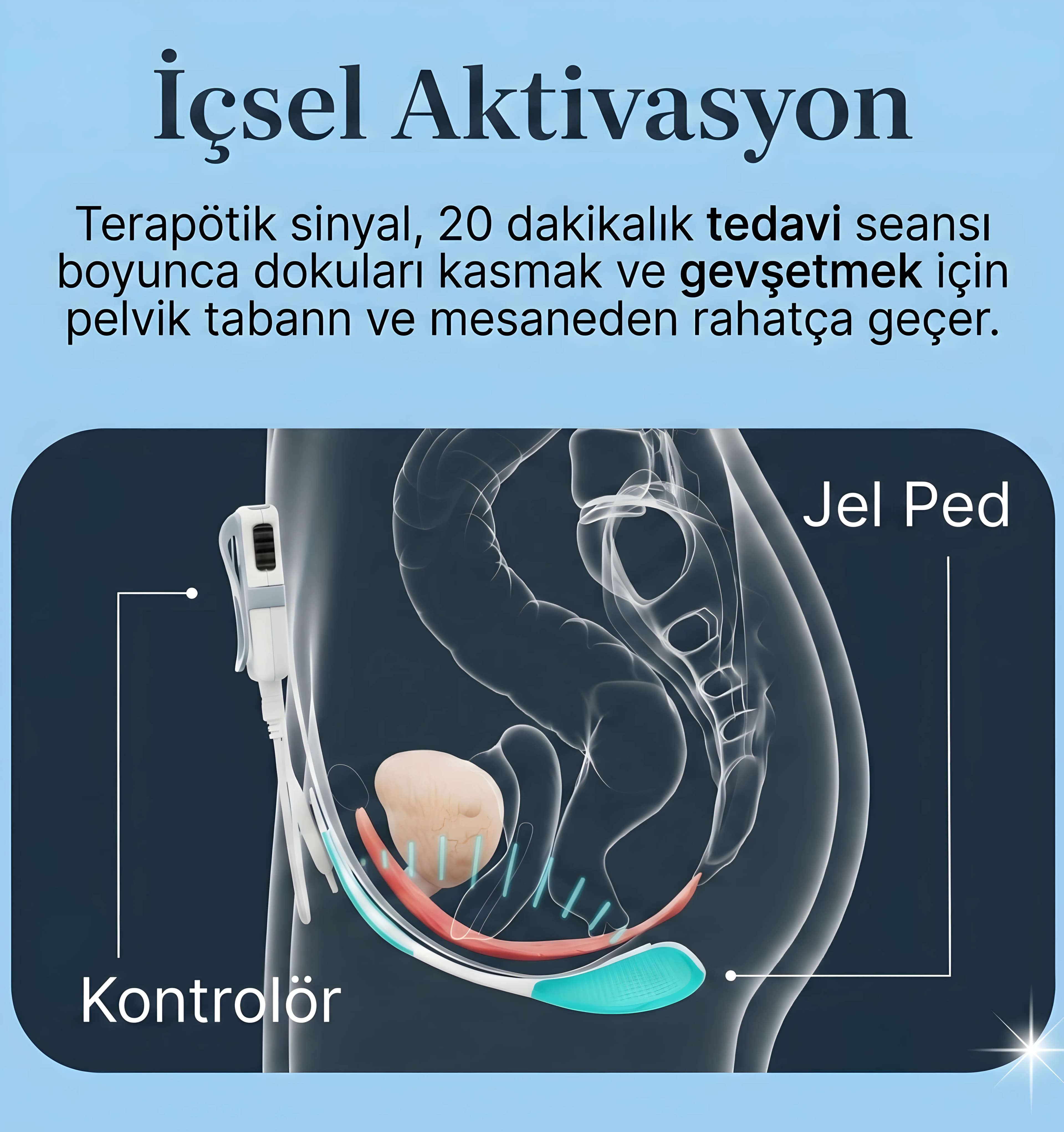 PelviQ görsel 2